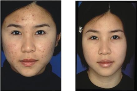 广州肤康皮肤病医院