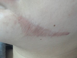 广州肤康皮肤病医院