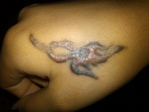 广州肤康皮肤病医院