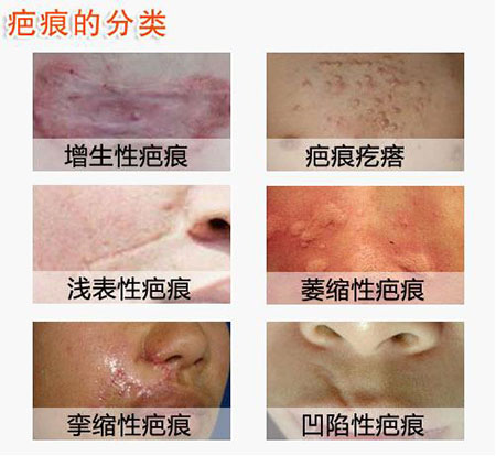 ���ݷ���Ƥ����ҽԺ