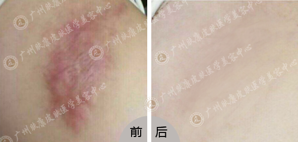 ���ݷ���Ƥ����ҽԺ