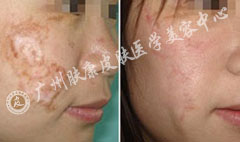 ���ݷ���Ƥ����ҽԺ