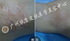 ���ݷ���Ƥ����ҽԺ