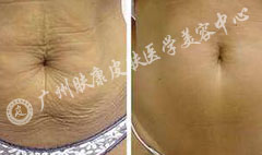 ���ݷ���Ƥ����ҽԺ