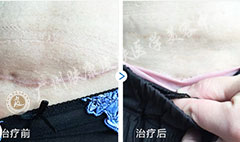 ���ݷ���Ƥ����ҽԺ