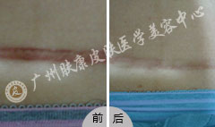 ���ݷ���Ƥ����ҽԺ