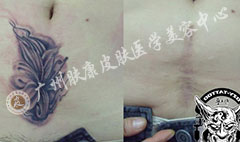 ���ݷ���Ƥ����ҽԺ