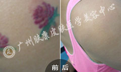 ���ݷ���Ƥ����ҽԺ