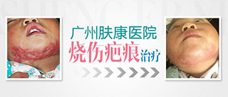 ���ݷ���Ƥ����ҽԺ