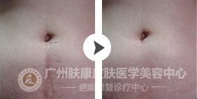 ���ݷ���Ƥ����ҽԺ