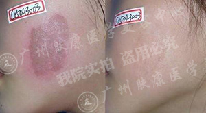 ���ݷ���Ƥ����ҽԺ