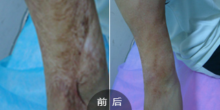 ���ݷ���Ƥ����ҽԺ