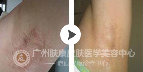 ���ݷ���Ƥ����ҽԺ