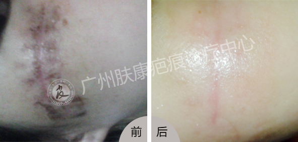 ���ݷ���Ƥ����ҽԺ