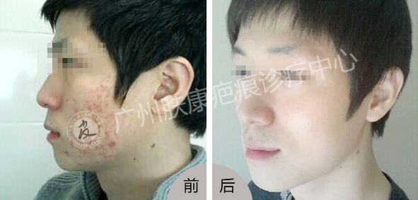 ���ݷ���Ƥ����ҽԺ