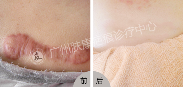 ���ݷ���Ƥ����ҽԺ