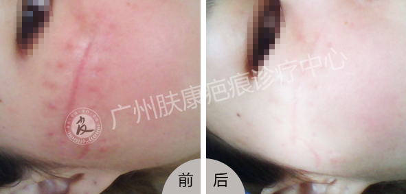 ���ݷ���Ƥ����ҽԺ