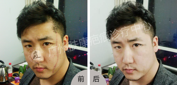 广州肤康皮肤病医院