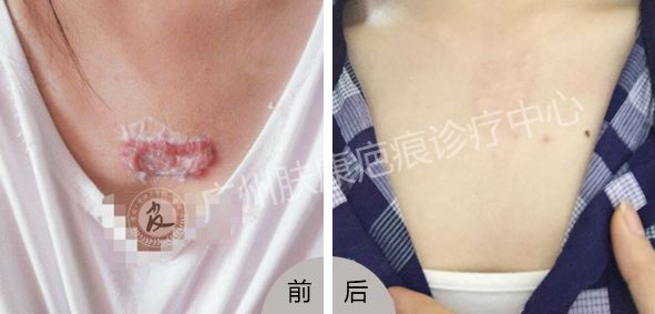 ���ݷ���Ƥ����ҽԺ