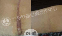 广州肤康皮肤病医院