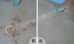 ���ݷ���Ƥ����ҽԺ