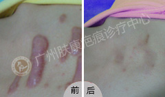 ���ݷ���Ƥ����ҽԺ