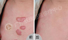 ���ݷ���Ƥ����ҽԺ