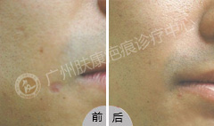 ���ݷ���Ƥ����ҽԺ