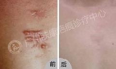 ���ݷ���Ƥ����ҽԺ