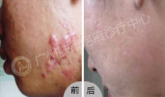 ���ݷ���Ƥ����ҽԺ