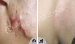 ���ݷ���Ƥ����ҽԺ