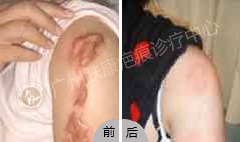 ���ݷ���Ƥ����ҽԺ