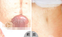 ���ݷ���Ƥ����ҽԺ