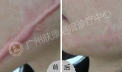 ���ݷ���Ƥ����ҽԺ