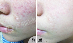 ���ݷ���Ƥ����ҽԺ