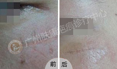 ���ݷ���Ƥ����ҽԺ