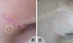 ���ݷ���Ƥ����ҽԺ