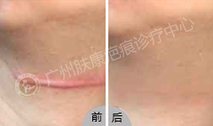 ���ݷ���Ƥ����ҽԺ