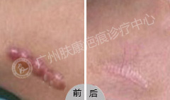 ���ݷ���Ƥ����ҽԺ