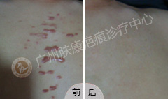 ���ݷ���Ƥ����ҽԺ