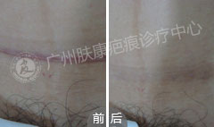 ���ݷ���Ƥ����ҽԺ