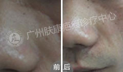 ���ݷ���Ƥ����ҽԺ