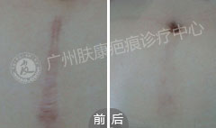 广州肤康皮肤病医院