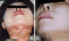 ���ݷ���Ƥ����ҽԺ