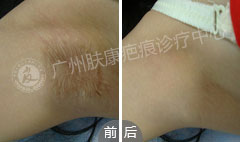 ���ݷ���Ƥ����ҽԺ