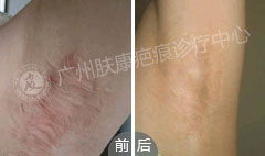 ���ݷ���Ƥ����ҽԺ