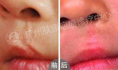 ���ݷ���Ƥ����ҽԺ