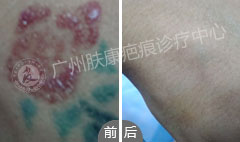 ���ݷ���Ƥ����ҽԺ