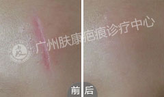 ���ݷ���Ƥ����ҽԺ