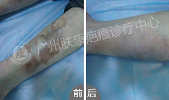 ���ݷ���Ƥ����ҽԺ